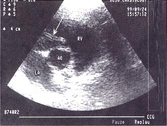 Heartworm_echo.jpg (33220 bytes)