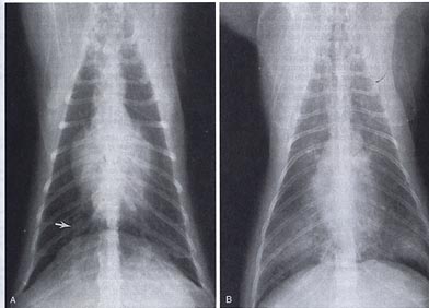 Heartworm_xray2.jpg (25463 bytes)