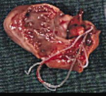 heartworms-1.gif (30754 bytes)