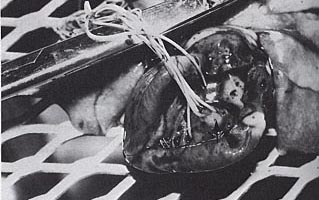heartworms_in_heart_3.jpg (28135 bytes)