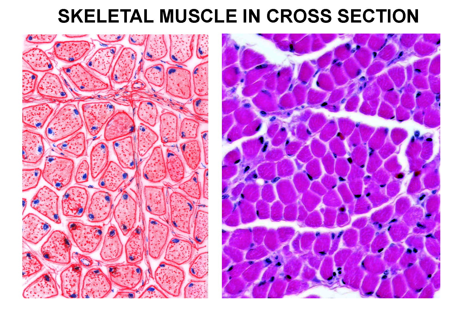 Skeletal Muscle X-Section Just For Fun Framed